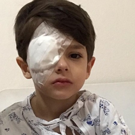 Menino queima o olho com álcool gel, e mãe faz alerta ao perigo