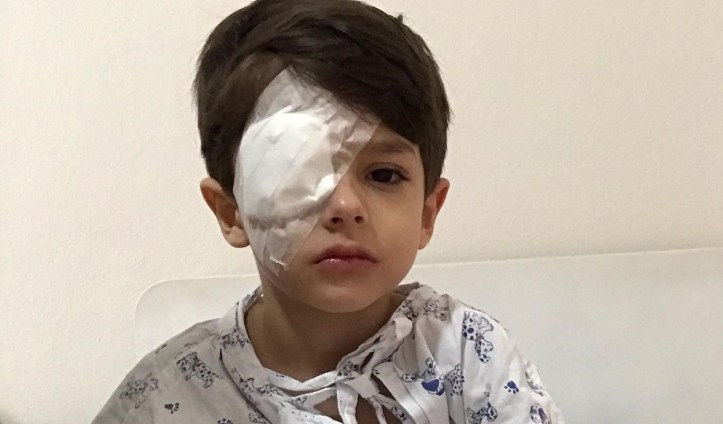 Menino queima o olho com álcool gel, e mãe faz alerta ao perigo